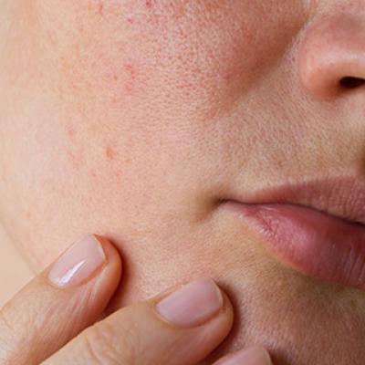 Home Remedies For Dry Skin​