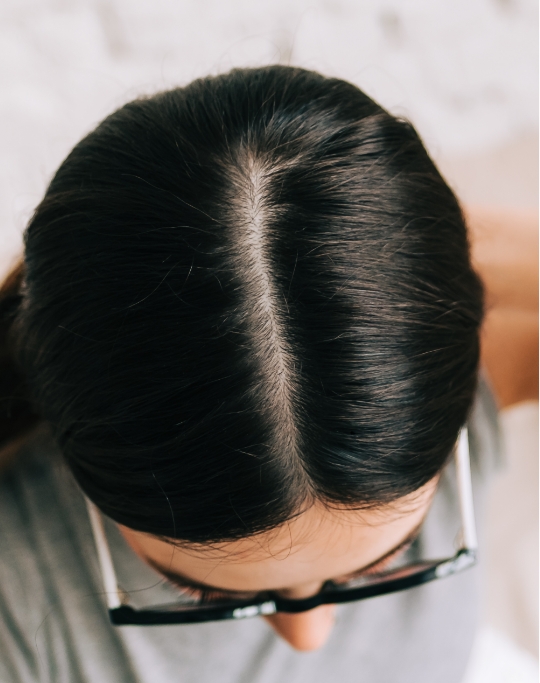 NOURISHING YOUR SCALP