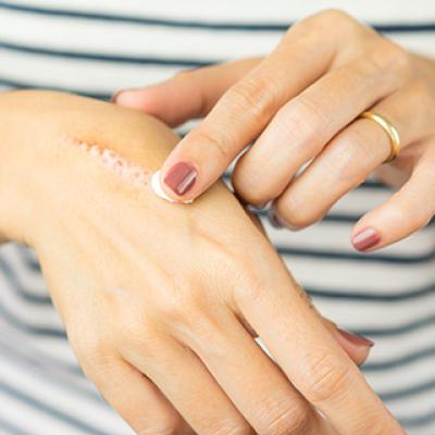 Home Remedies For Wounds​