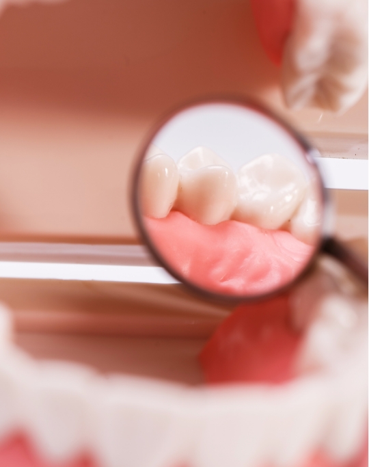 GUM STRENGTHENING